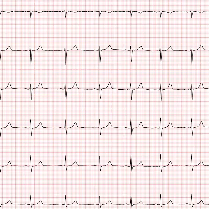 Exame de eletrocardiograma veterinário
