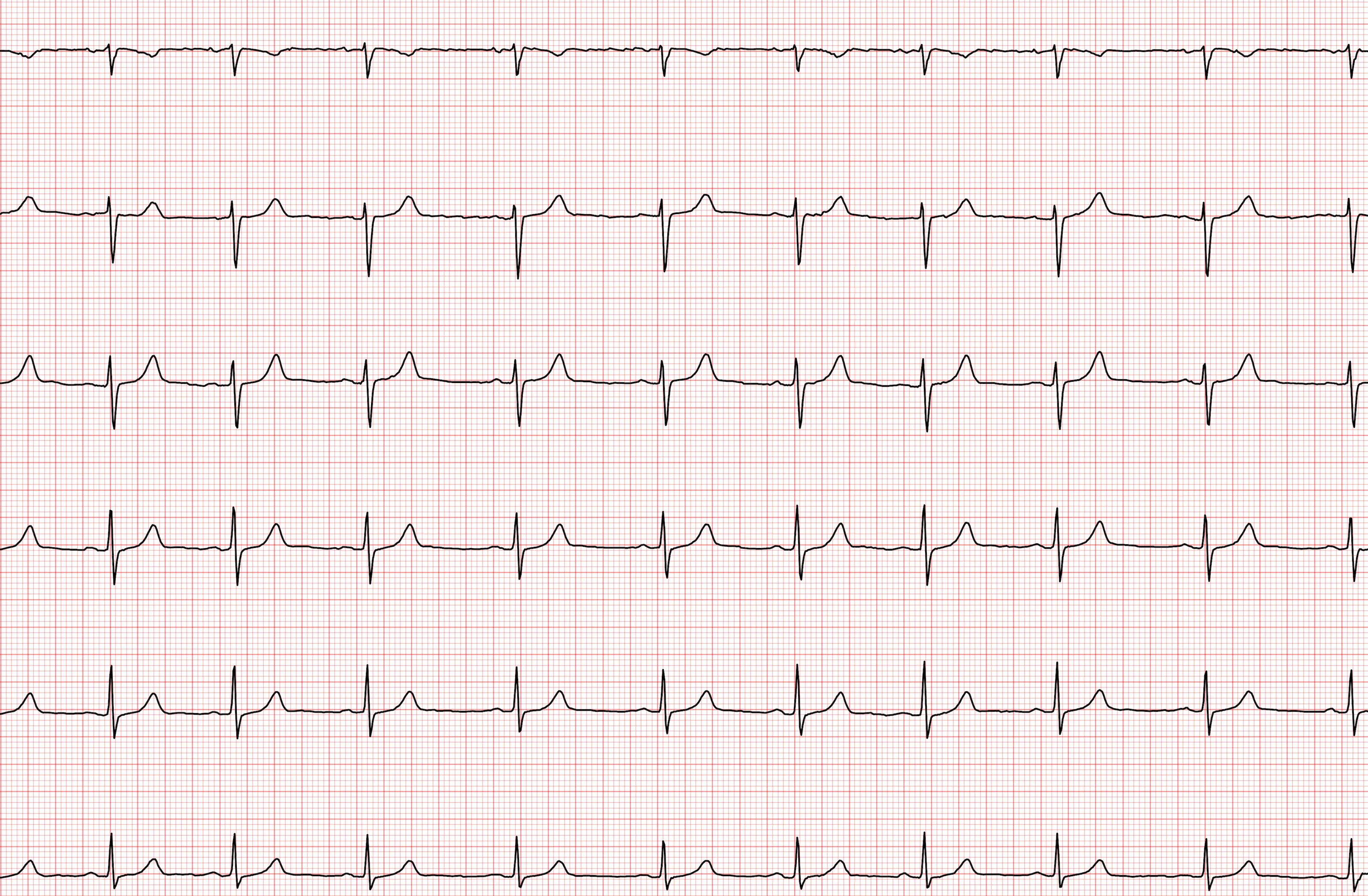 Fundo decorativo com traçado de eletrocardiograma